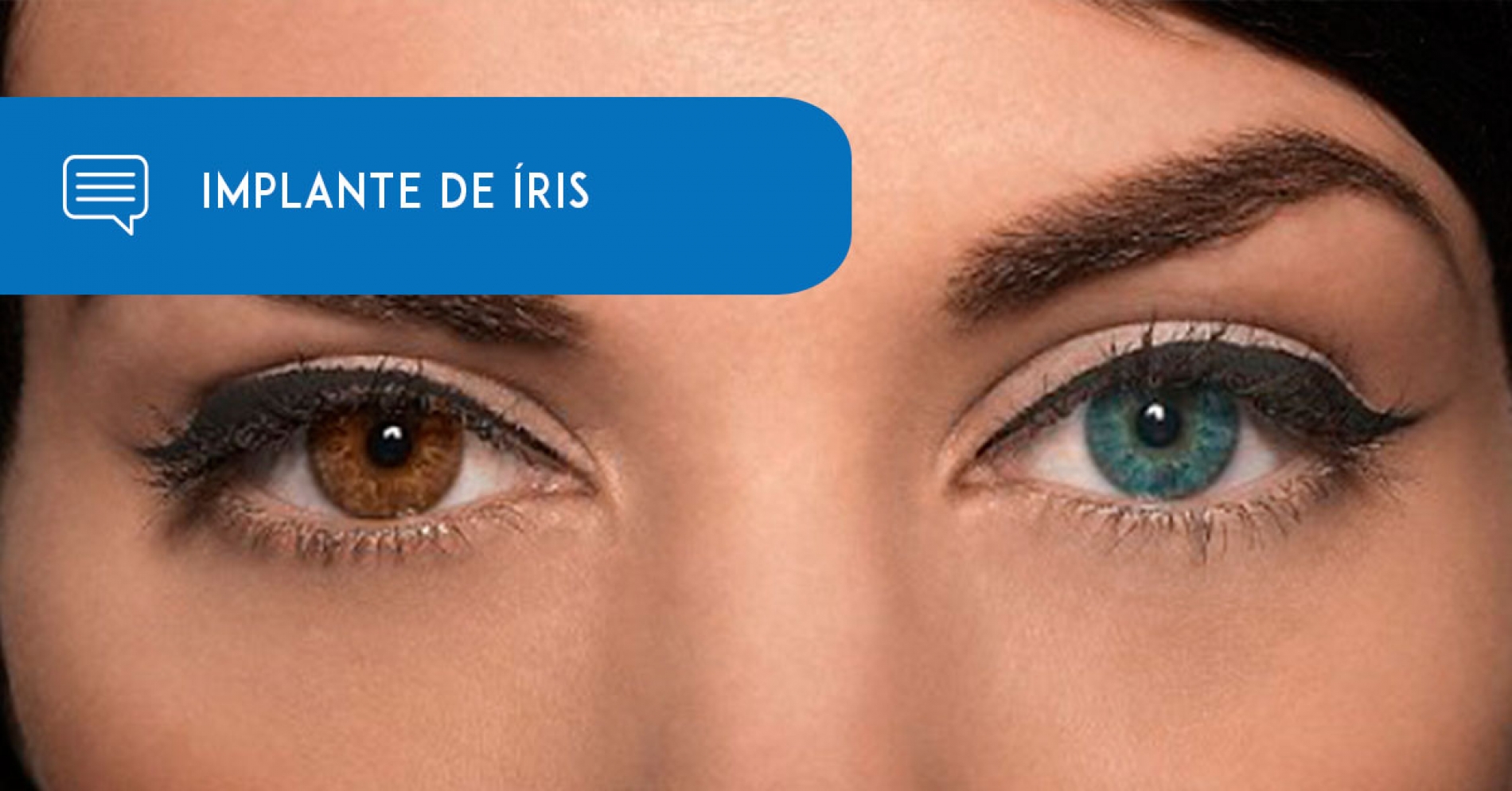 Implantes de íris têm risco de danos permanentes nos olhos, e perda de visão. - Eduardo Paulino