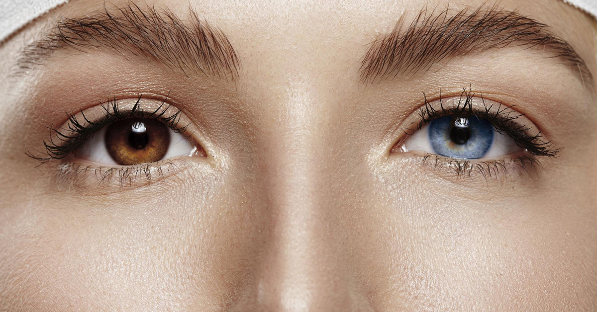 Saiba mais sobre a heterocromia ocular - Eduardo Paulino