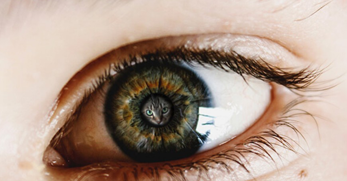 Toxoplasmose Ocular: infecção atinge várias partes do olho. - Eduardo Paulino