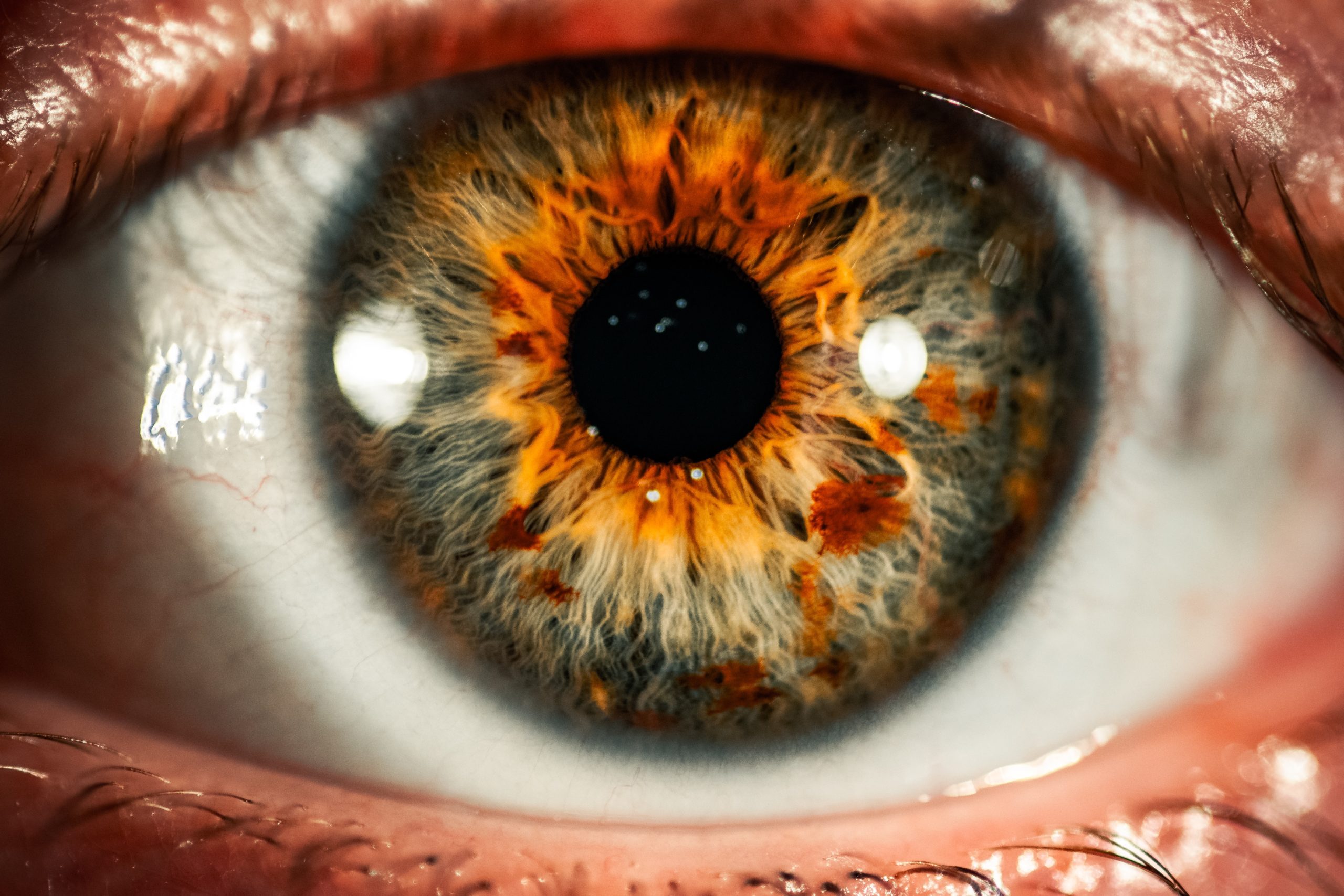 Prevenção de Doenças Oculares  - Eduardo Paulino